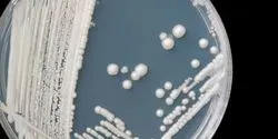 A commercialization agreement for ibrexafungerp