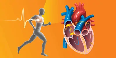 On the left, a silhouette of a human body jogs while an electrical heart activity signal extends from its heart. On the right, an anatomical structure of the interior of the heart shows the right atrium, right ventricle, left atrium, left ventricle, sinoatrial node, atrioventricular node, pulmonary artery, aorta, bundle of His, and left and right bundle branches. Arrows show the path of blood flow between the heart chambers.