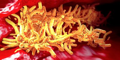 A 3D illustration of tuberculosis bacteria in the pulmonary tract. 