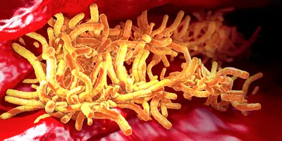 A 3D illustration of tuberculosis bacteria in the pulmonary tract.