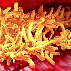 A 3D illustration of tuberculosis bacteria in the pulmonary tract. 