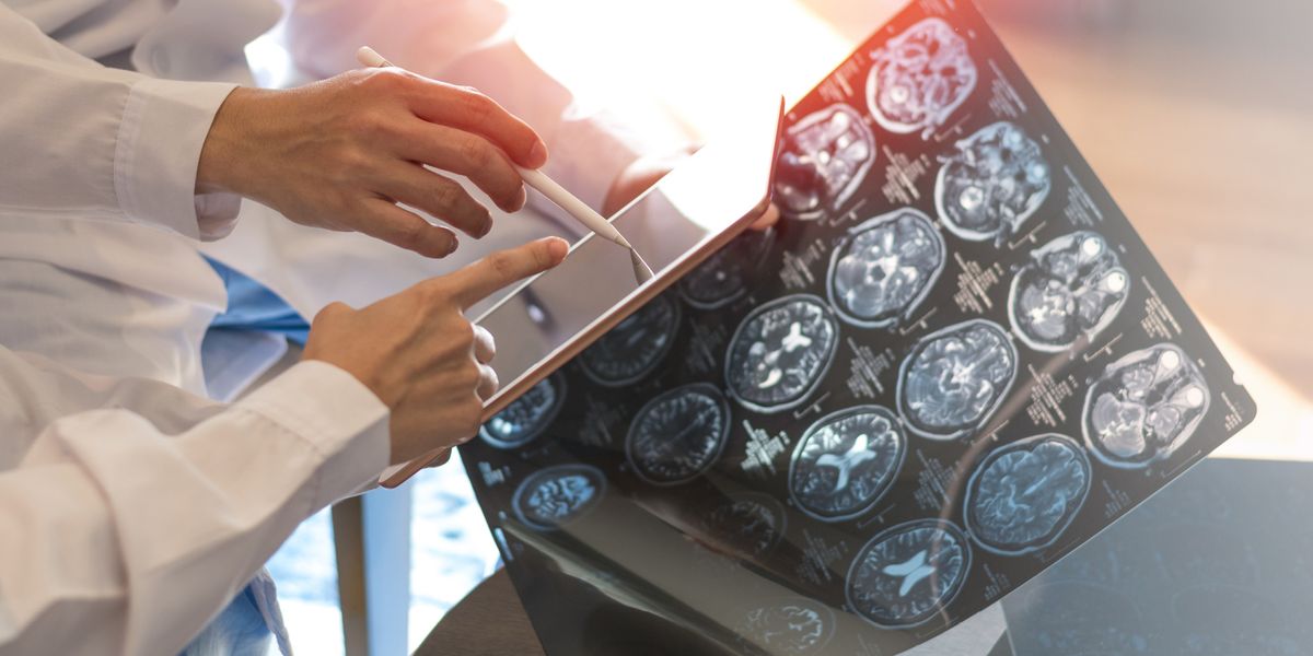 The bumpy road to treating multiple sclerosis with stem cells | Drug Discovery News The bumpy road to treating multiple sclerosis with stem cells | Drug Discovery News