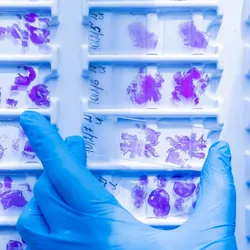 A hand in a blue glove picks a glass histology slide from a collection of histology slides in the background. 