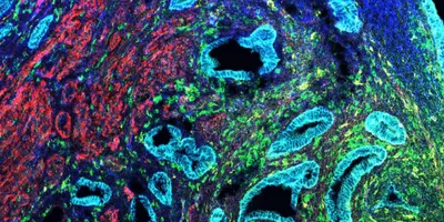 An imaging mass cytometry image of the endometrium showing proteins 