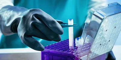 A gloved researcher’s hand uses tweezers to place a biological sample into a storage box for preservation.