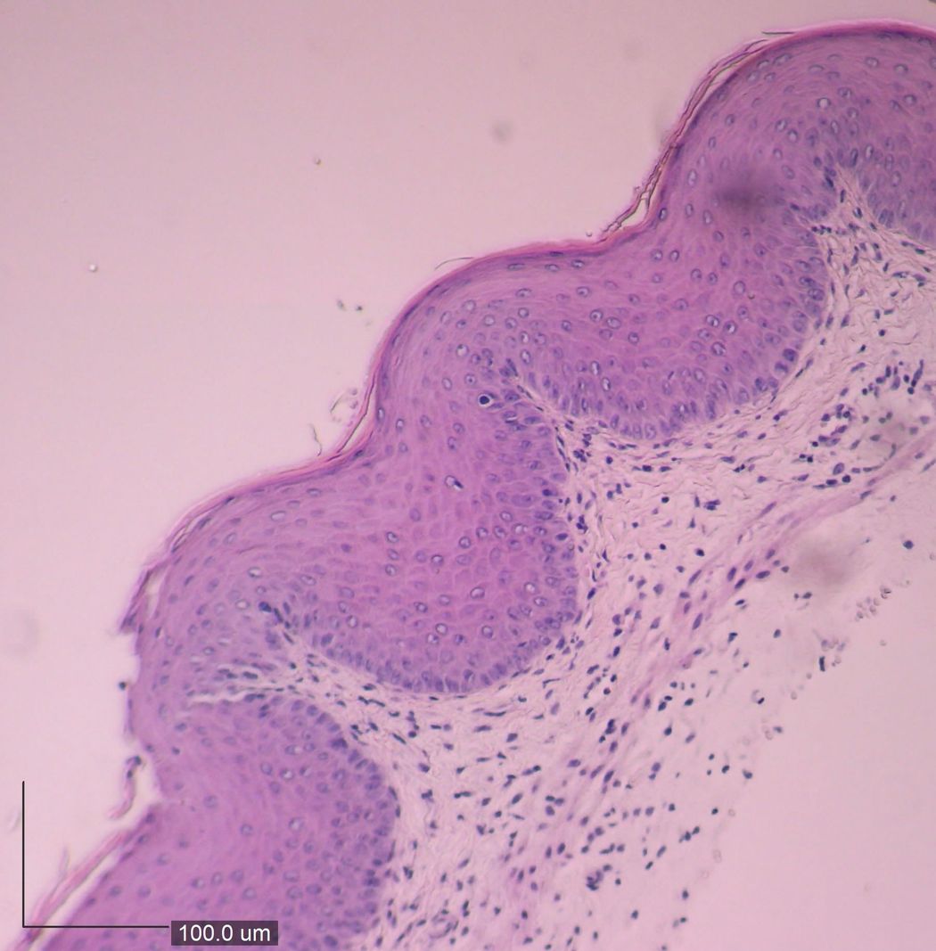 A histological section of mouse vaginal tissue infected with Candida albicans after treatment with cell-free supernatant of the strain Limosilactobacillus reuteri 29A. A histological section of mouse vaginal tissue infected with Candida albicans after treatment with cell-free supernatant of the strain Limosilactobacillus reuteri 29A.