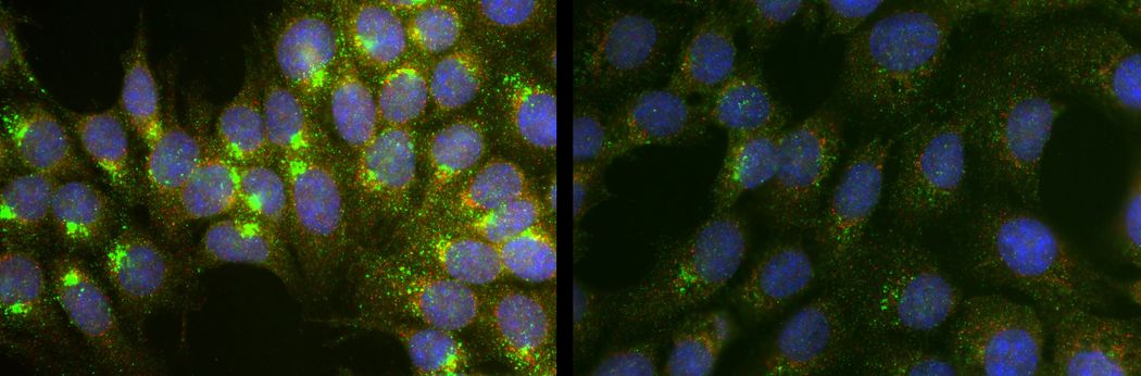 Fluorescent microscopy images show blue, green, orange specks against a black background. Fluorescent microscopy images show blue, green, orange specks against a black background.