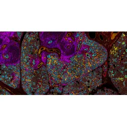 Orion 16 channel imaging of a section of salivary gland displaying Goujerot-Sjogren’s Syndrome. 