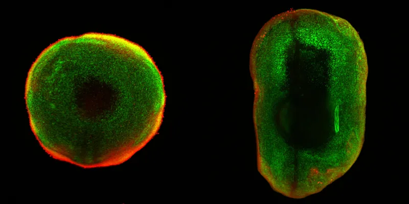 Immunofluorescence images of two organoids with a circular one on the left and a more elongated one on the right.