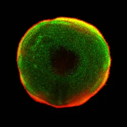Immunofluorescence images of two organoids with a circular one on the left and a more elongated one on the right.
