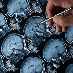 MRI Brain Scan of head and skull with hand pointing
