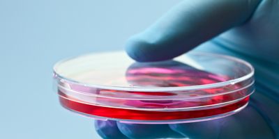 Gloved hand holding a petri dish containing red liquid culture medium against a light blue background.