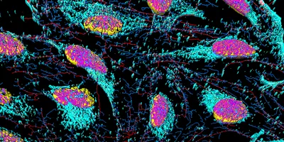 Fluorescent image of HeLa cells showing nuclei in pink, microfilaments in red and blue, and membrane particles in teal in spatial biology.