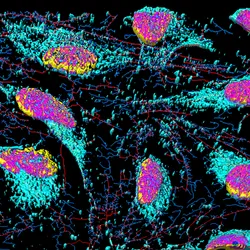 Fluorescent image of HeLa cells showing nuclei in pink, microfilaments in red and blue, and membrane particles in teal in spatial biology.