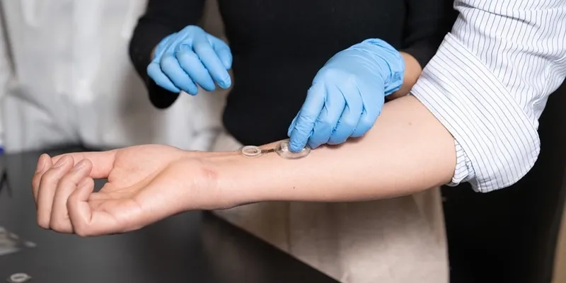 A person with gloves places a clear round device on the arm of another person.