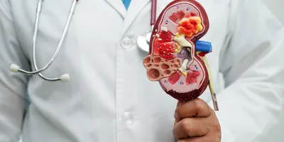 Doctor in a white lab coat holds up a plastic model of a kidney. 