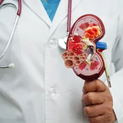 Doctor in a white lab coat holds up a plastic model of a kidney. 
