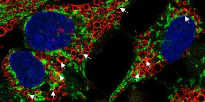 Syncell’s Microscoop Mint has identified proteins uniquely localized at the peridroplet mitochondrial interface, a region critical for mitochondrial function in non-alcoholic fatty liver disease.