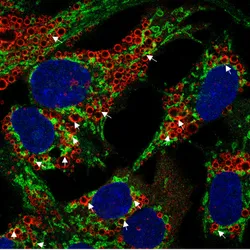 Syncell’s Microscoop Mint has identified proteins uniquely localized at the peridroplet mitochondrial interface, a region critical for mitochondrial function in non-alcoholic fatty liver disease.