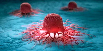 3D illustration of cancer cells spreading across tissue, showing invasive growth with blood vessel-like extensions.