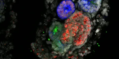 A kidney organoid showing blue, green, and red fluorescence.