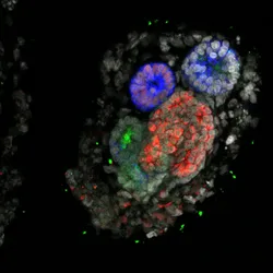 A kidney organoid showing blue, green, and red fluorescence.