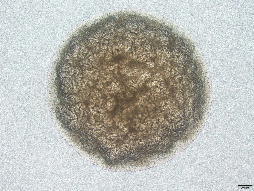 A microscopic image of a kidney organoid A microscopic image of a kidney organoid