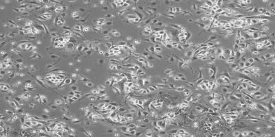 Mouse bone marrow-derived macrophages on a gray background. 
