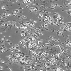 Mouse bone marrow-derived macrophages on a gray background.
