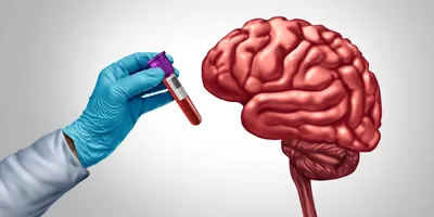A gloved hand holding a vial of blood next to an image of a human brain on a white background.