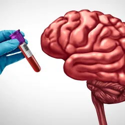 A gloved hand holding a vial of blood next to an image of a human brain on a white background.