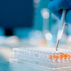 Lab technician injecting liquid into a microtiter plate