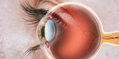  Close-up of a human eye with a medical illustration overlay showing the internal anatomy, including the cornea, retina, and optic nerve.