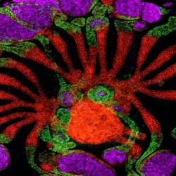 Fluorescent microscope image of a lab-grown human kidney assembloid showing a circular structure with branching red tubular formations radiating from the center, surrounded by clusters of purple and green cells against a black background.
