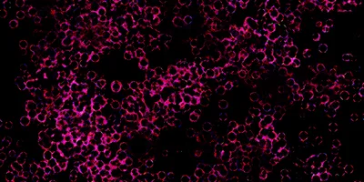 Fluorescence in situ hybridization cancer cells 