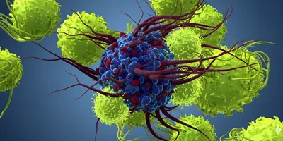 Cancer cell amid immune cells.