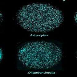 Black background image with blue cells