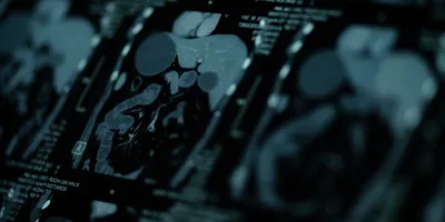 Magnetic Resonance Imaging-CT Scanning