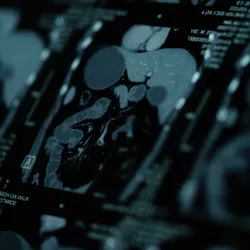 Magnetic Resonance Imaging-CT Scanning