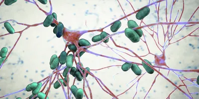 3D illustration of bacterial pathogens invading nerve cells in the brain.