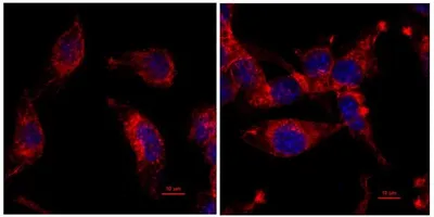 Red and blue colon cancer cells from mice are shown under a microscope.
