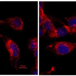 Red and blue colon cancer cells from mice are shown under a microscope.