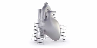 3D model of a heart with scaffolding, symbolizing heart failure treatment.