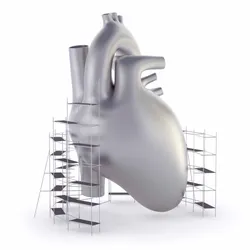 3D model of a heart with scaffolding, symbolizing heart failure treatment.