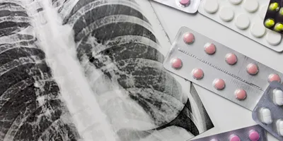 Fluorography, x-ray and different pills in blisters on white background