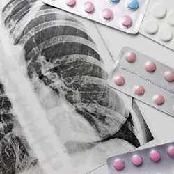 Fluorography, x-ray and different pills in blisters on white background