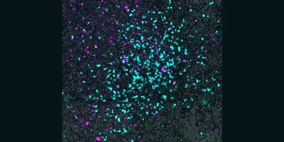 A microscopy image of cyan bacteria cells invade gray lung cancer cells on a black background.