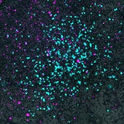 A microscopy image of cyan bacteria cells invade gray lung cancer cells on a black background.