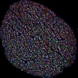 Multicolor bundle of human vagus nerve, showing cross sections of individual nerve fibers in different colors
