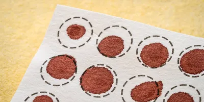 Fingerstick dried blood test samples on paper